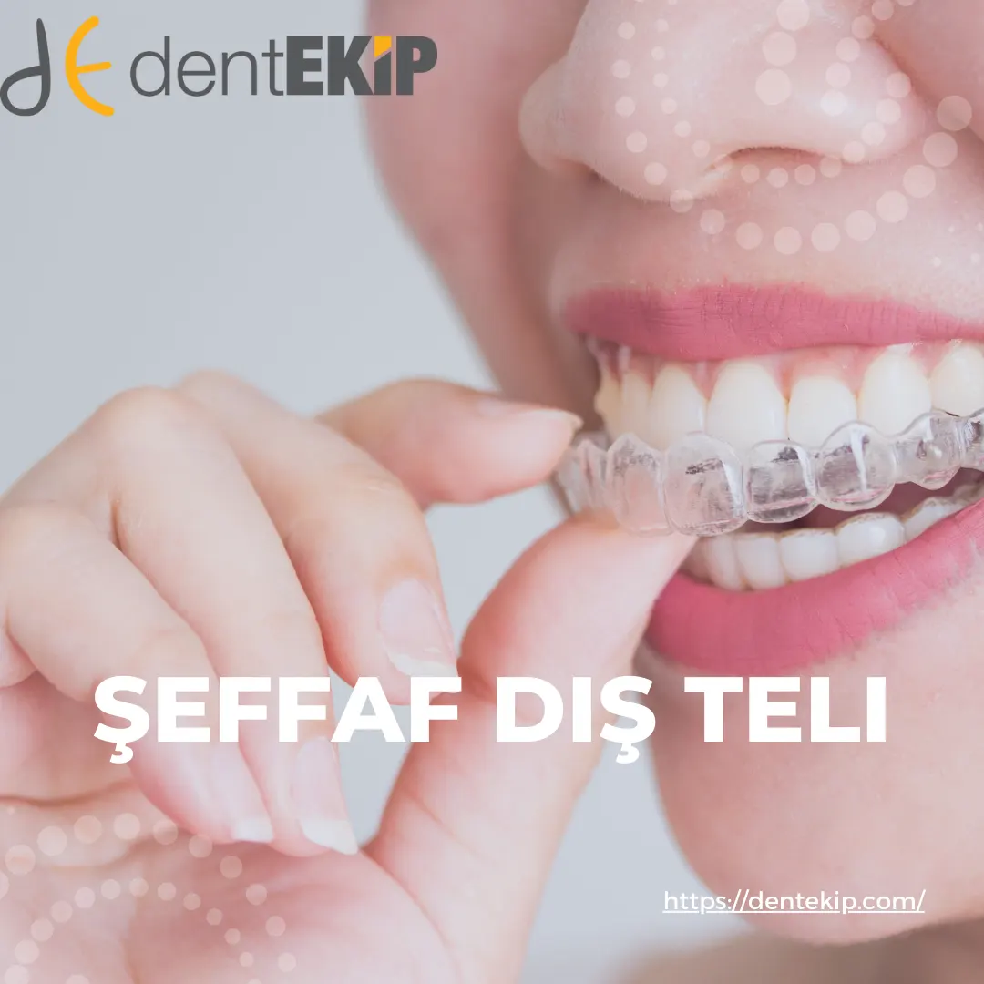 Ortodonti | Şeffaf Plak